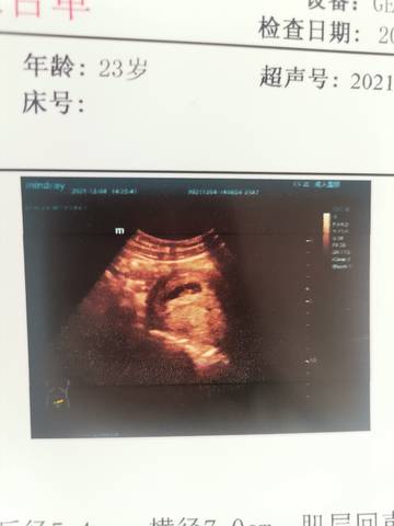 journal_insert_pic_1673509929