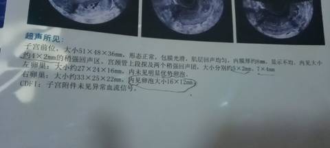 journal_insert_pic_1682302587