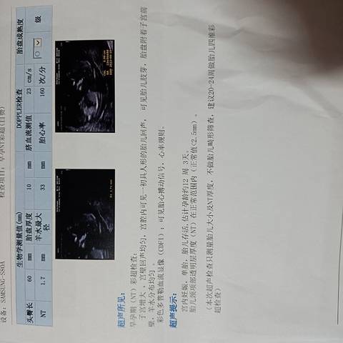 journal_insert_pic_1675958552