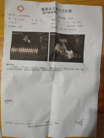 journal_insert_pic_1675994740