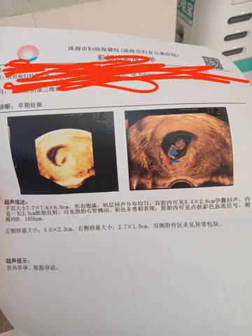 journal_insert_pic_1677251363