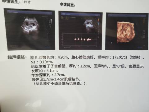 journal_insert_pic_1678934457