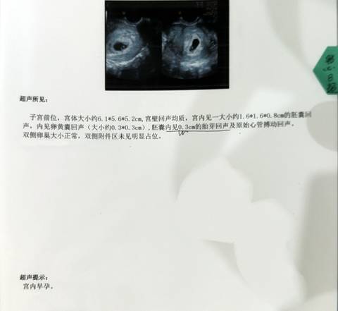 journal_insert_pic_1681915322