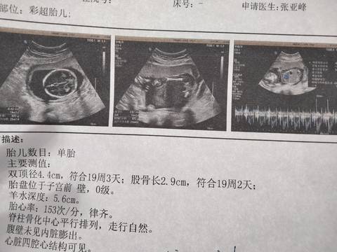 journal_insert_pic_1674715198