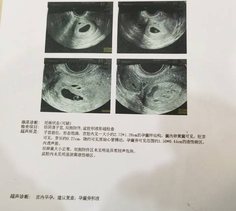 journal_insert_pic_1684412055