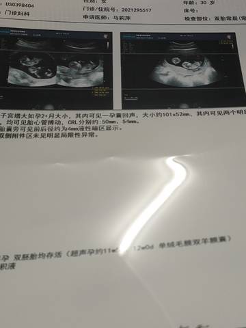 journal_insert_pic_1681733383