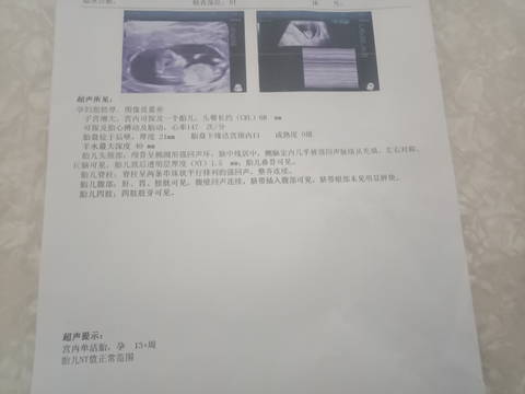 journal_insert_pic_1740904874