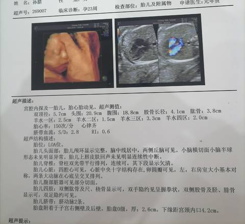 journal_insert_pic_1679242175
