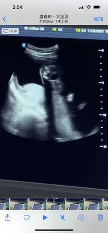 journal_insert_pic_1677719813