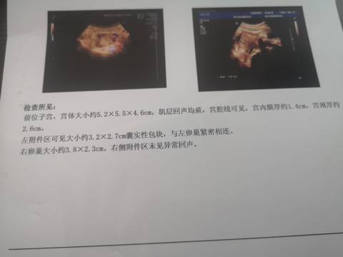 journal_insert_pic_1686545215