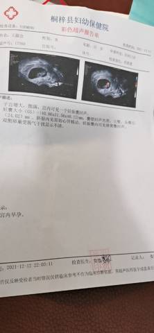 journal_insert_pic_1679161269