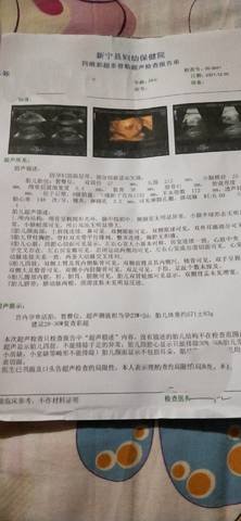 journal_insert_pic_1689691544