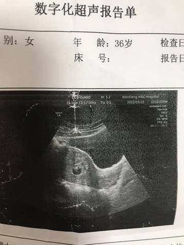 journal_insert_pic_1741112364