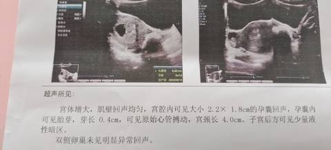 journal_insert_pic_1689212075