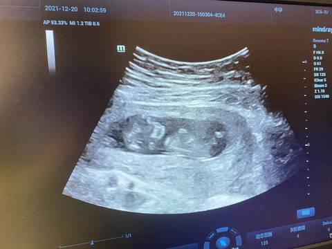 journal_insert_pic_1687195313