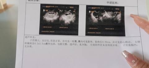 journal_insert_pic_1719910815