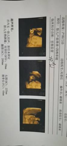 journal_insert_pic_1685291661