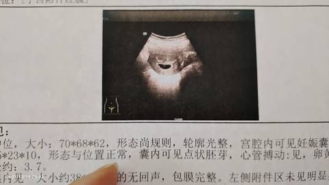 journal_insert_pic_1679888753