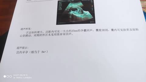 journal_insert_pic_1740867515