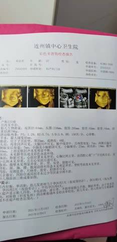 journal_insert_pic_1676796529