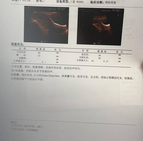 journal_insert_pic_1682751659