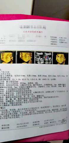 journal_insert_pic_1676802274