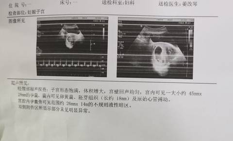 journal_insert_pic_1683780308