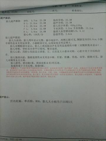 journal_insert_pic_1677525413