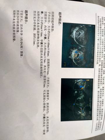 journal_insert_pic_1682915928