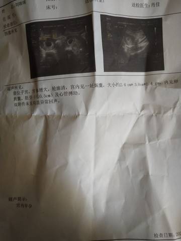 journal_insert_pic_1688823545