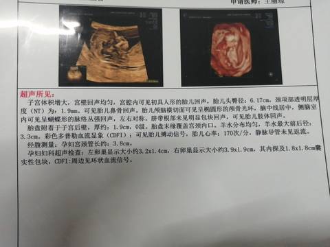 journal_insert_pic_1678086402