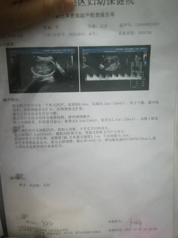 journal_insert_pic_1688489471