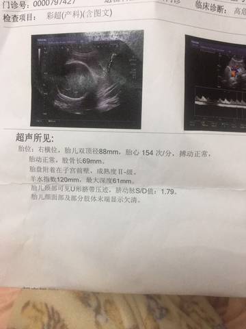 journal_insert_pic_1679245797