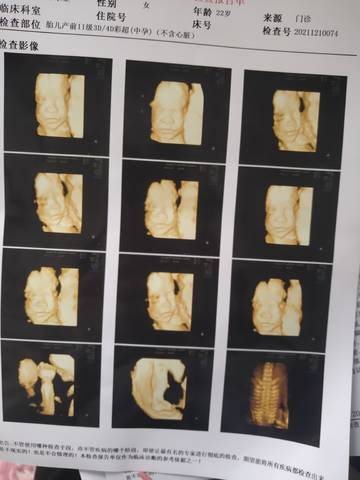 journal_insert_pic_1677941823