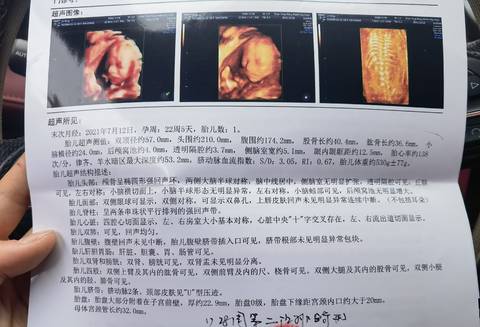 journal_insert_pic_1686529259