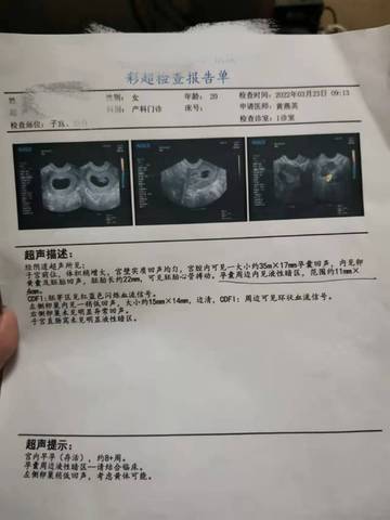 journal_insert_pic_1741108687