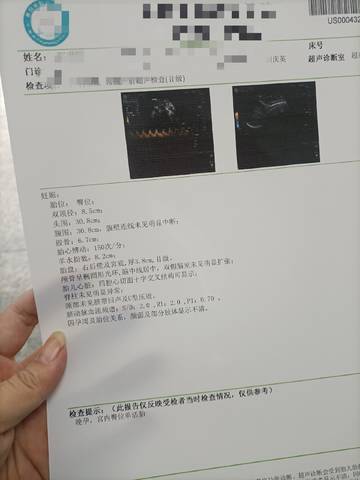 journal_insert_pic_1677300223