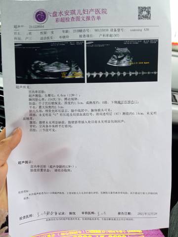 journal_insert_pic_1688075656