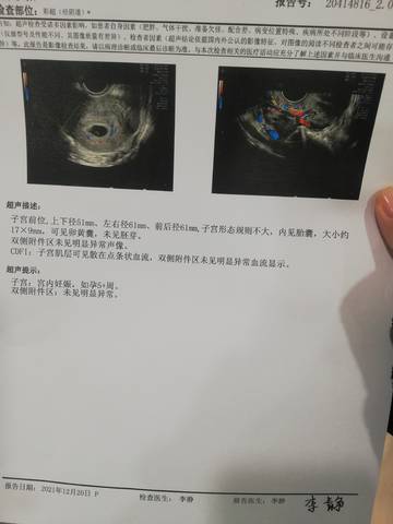journal_insert_pic_1683232301