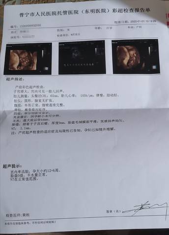 journal_insert_pic_1690037956