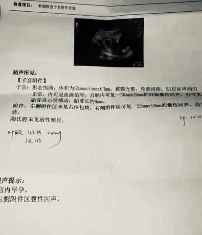 journal_insert_pic_1684213680