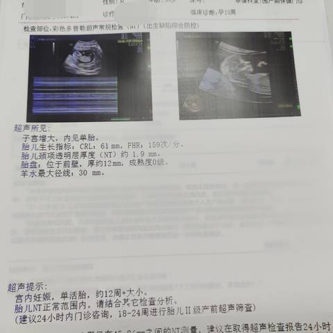 journal_insert_pic_1689723193