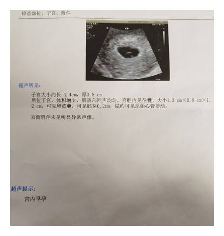 journal_insert_pic_1689008789