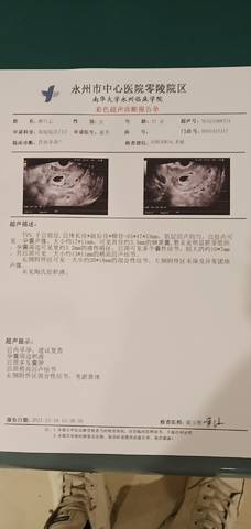 journal_insert_pic_1681170197