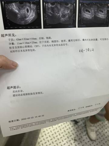 journal_insert_pic_1740814098