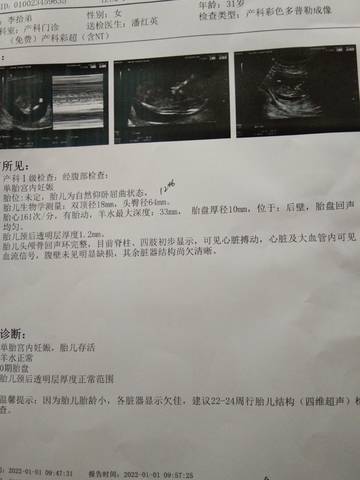 journal_insert_pic_1690390995