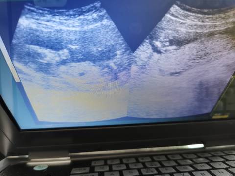 journal_insert_pic_1690280612