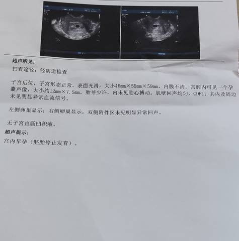 journal_insert_pic_1677480926