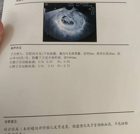 journal_insert_pic_1673339732