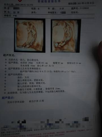 journal_insert_pic_1683197634